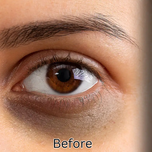 24K Gold Collagen Eye Patch - 40 Pack™