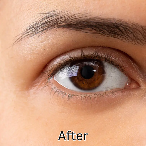 24K Gold Collagen Eye Patch - 20 Pack™